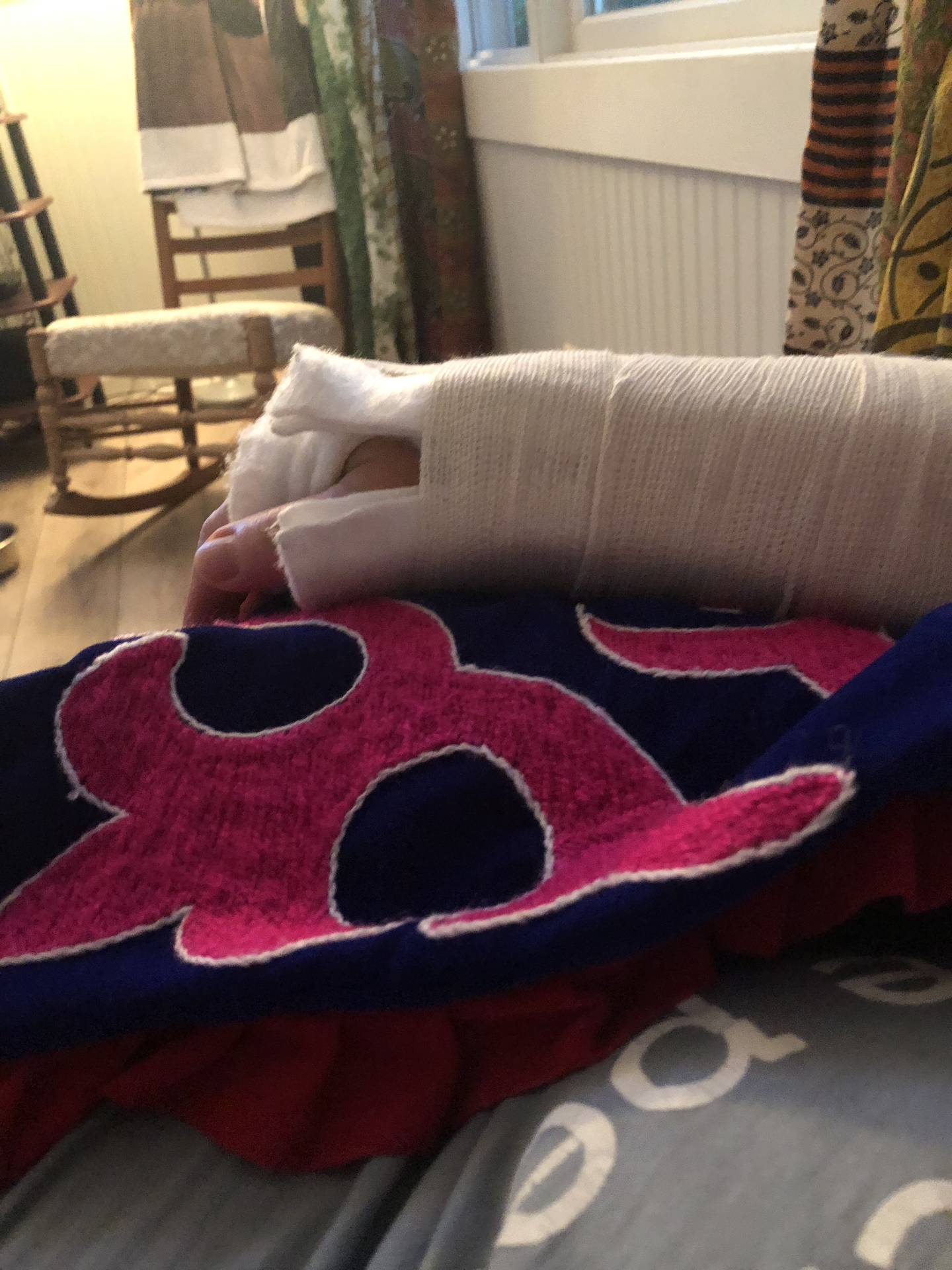 close up of right arm in splint resting on colorful pillow